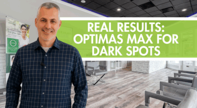 Optimas Max and Morpheus8 for Dark Spots