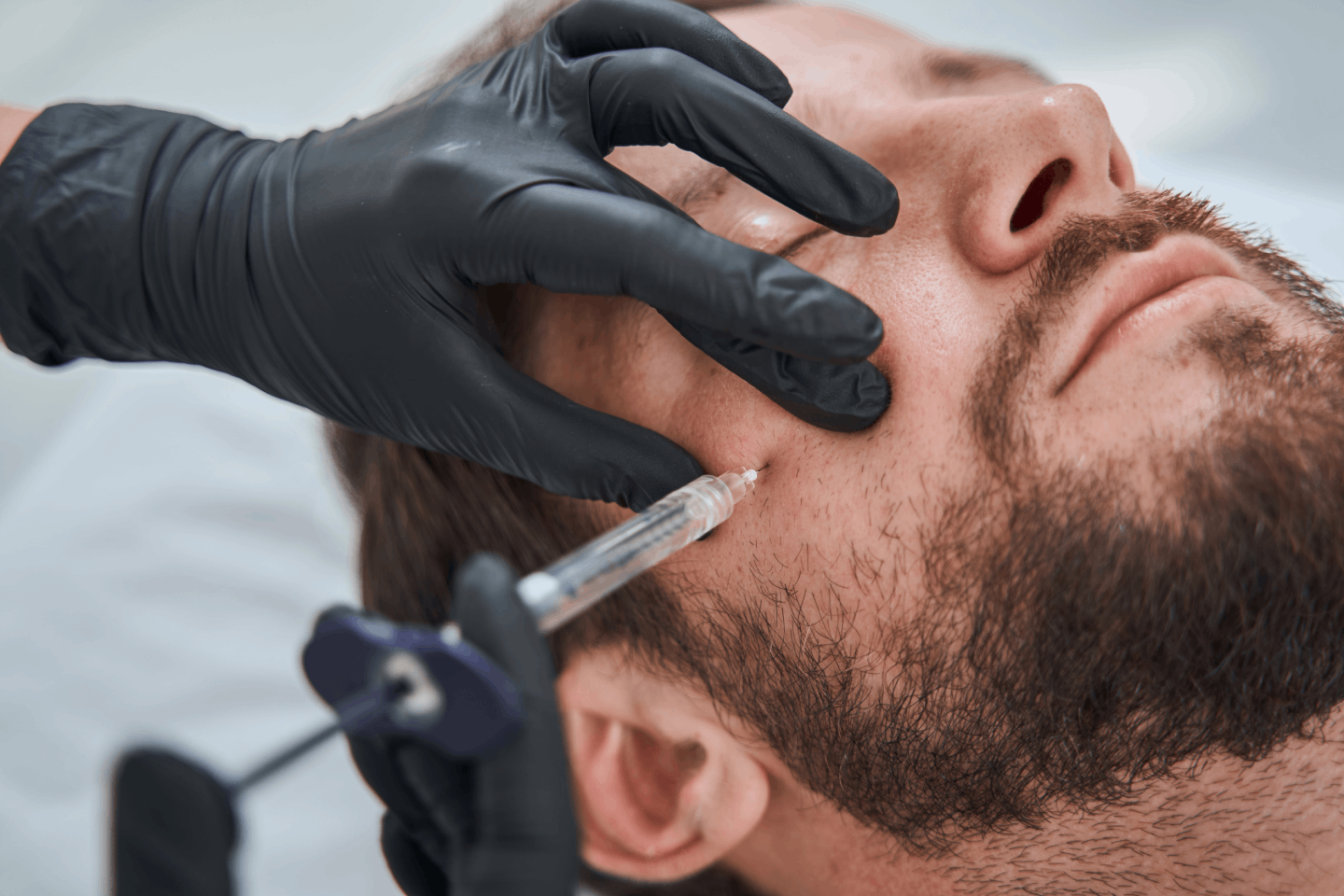 Discover the Versatile Benefits of Restylane