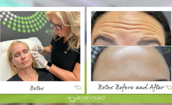  Botox vs. Dysport: What’s the Difference — and Which One Is Right for You? 