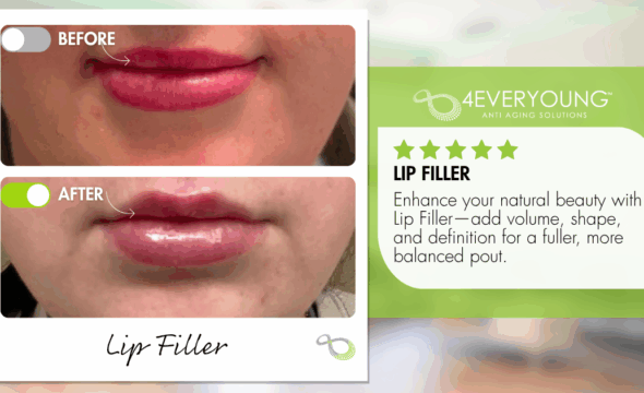  Restore, Define, and Enhance: Why Juvederm Lip Fillers Are Blue Bell’s Go-To for Natural Beauty 