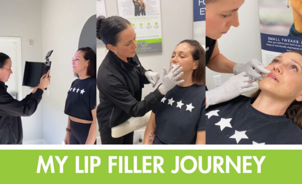  The Ultimate Guide to Lip Filler at 4Ever Young Bridgeport: Natural Enhancement, Expert Care 