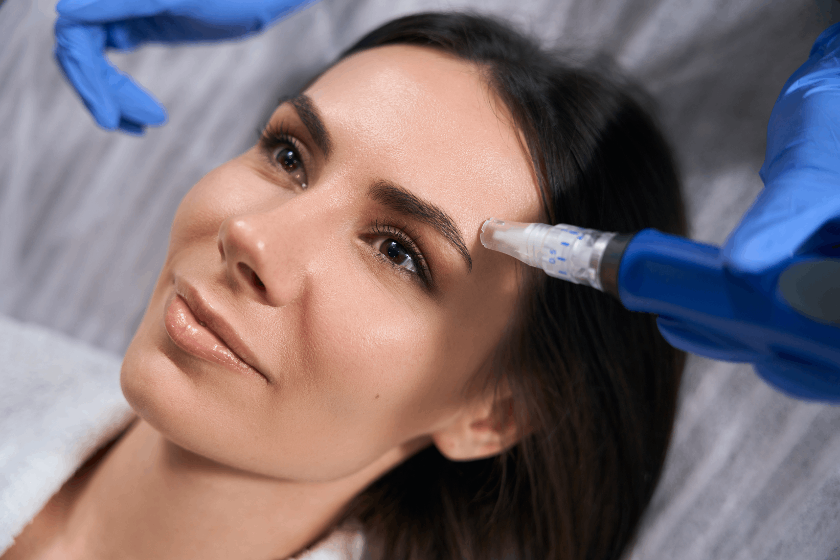 SkinPen® Microneedling Stimulates Your Own Collagen