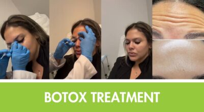 botox near me Hoboken med spa 4Ever young anti aging solutions