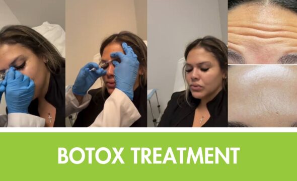How to Smooth Wrinkles & Refresh Your Look Naturally: Botox Near Me in Hoboken, NJ