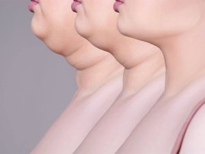 Say Goodbye to Turkey Neck