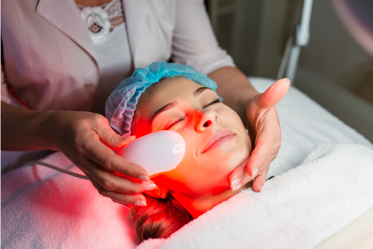 IPL Photofacial