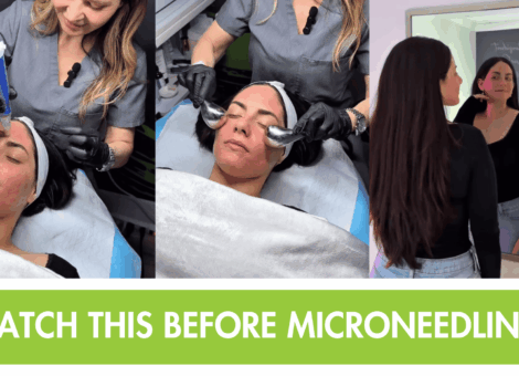 Microneedling New Braunfels