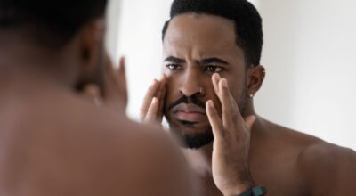 Increasing Popularity of Botox for Men