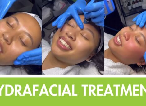 Hydrafacial treatment 4ever young anti aging solutions Ramsey medspa
