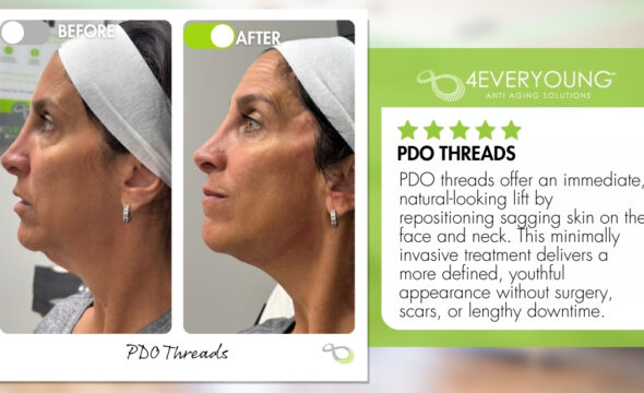  PDO Threads: Spring Lake’s Modern Solution for Lifted, Youthful Skin Without Surgery 