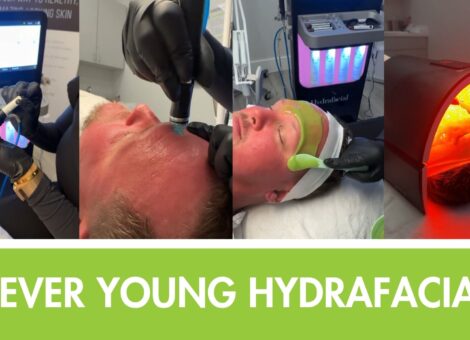 4ever young hydrafacial