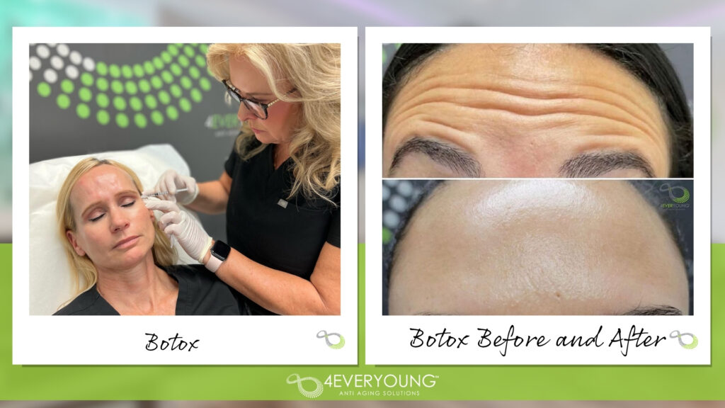 botox near me wilchester