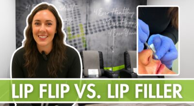 Lip Flip vs. Lip Filler