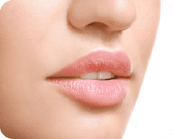 Close-up of a woman's full, naturally shaped lips and smooth skin highlighting ideal lip filler results.