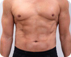 Shirtless man displaying a lean, defined abdomen and chest, illustrating the body composition results achievable with weight loss therapy.