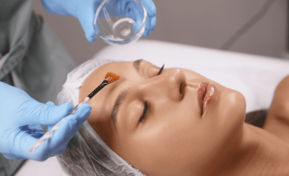 Chemical Peel Treatments