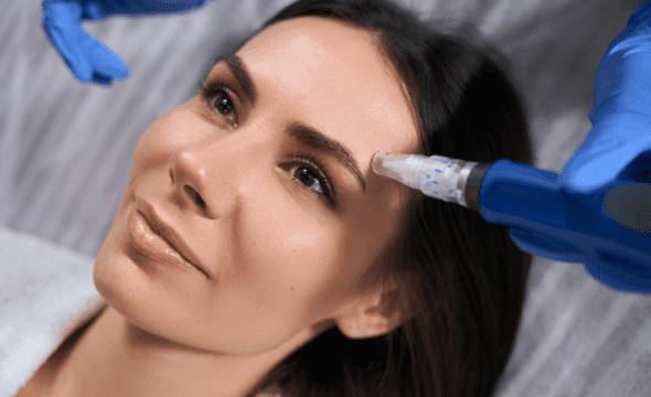 SkinPen® Microneedling Treatment