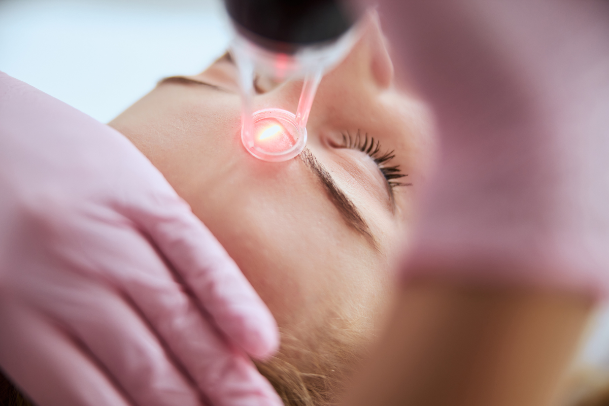 Hyperpigmentation removal treatment using a focused laser device near a woman’s eye.
