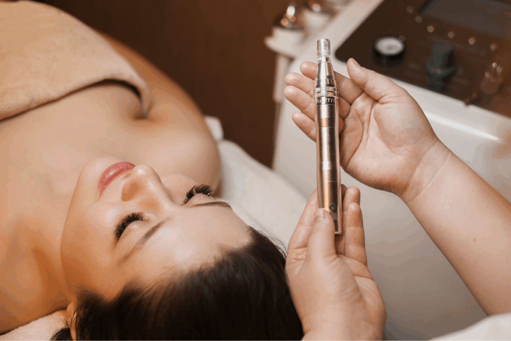 Morpheus8 procedure preparation with a handheld RF microneedling device before treatment.